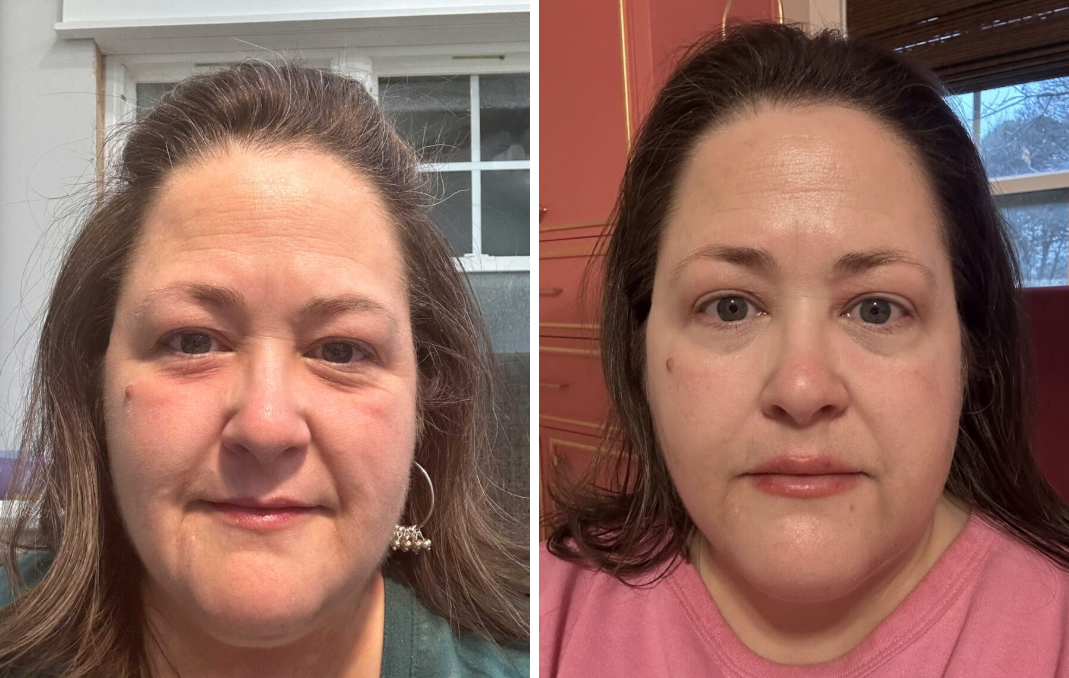 A Personal Update (My Year of No Sugar, Weight Loss, Castor Oil, Etc.)