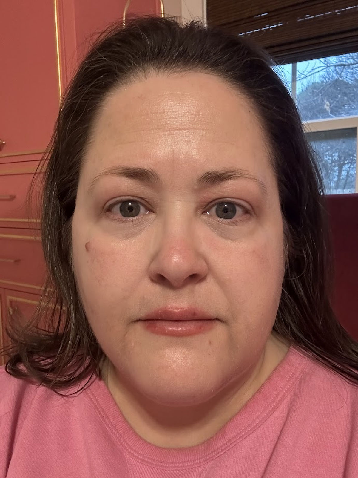 A Personal Update (My Year of No Sugar, Weight Loss, Castor Oil, Etc